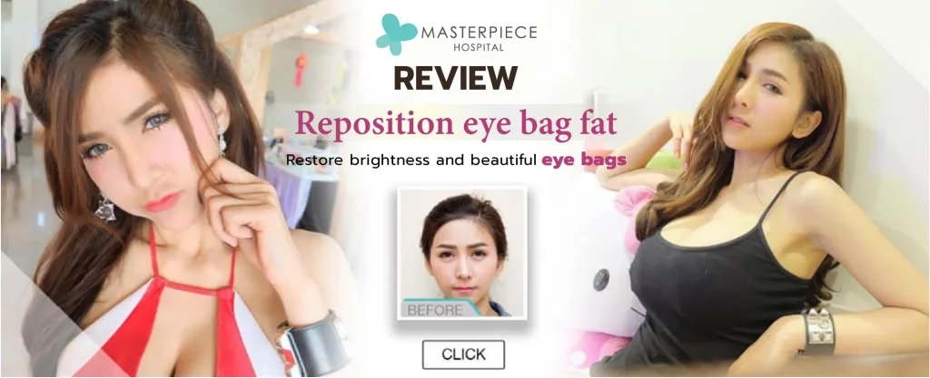review Reposition eyebag fat