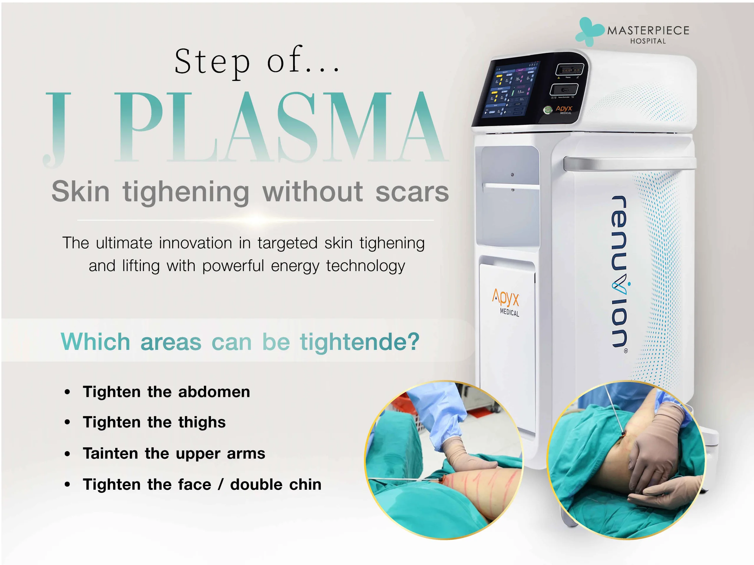 Steps for J-Plasma Treatment