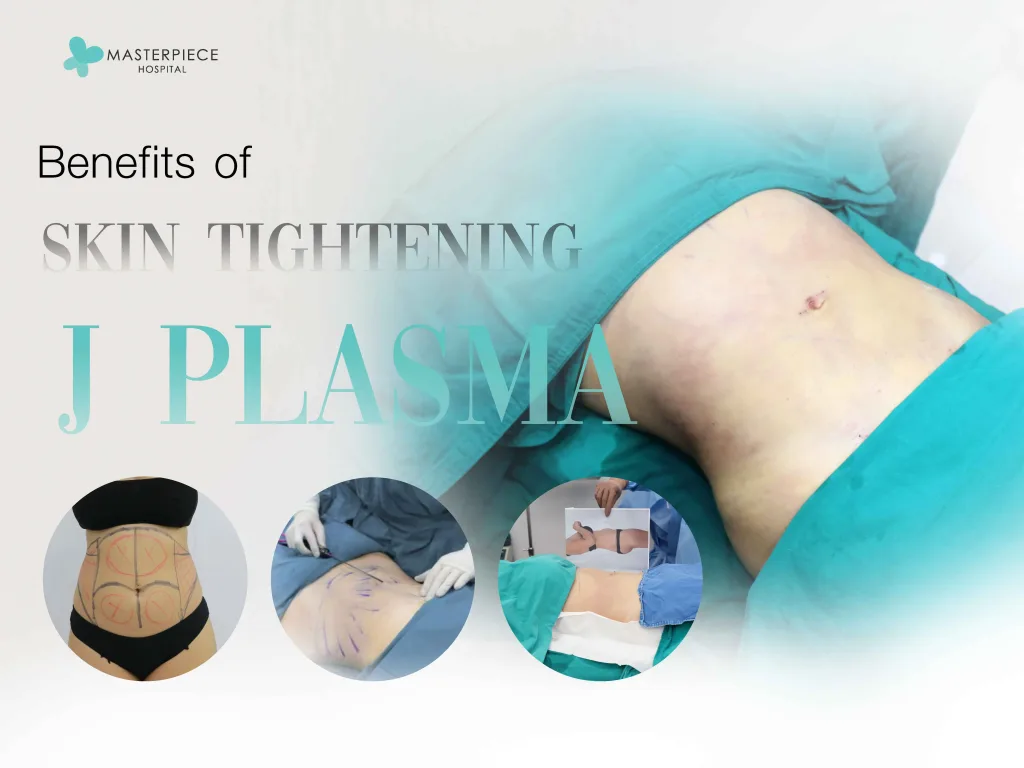 Benefits of Skin Tightening with J-Plasma
