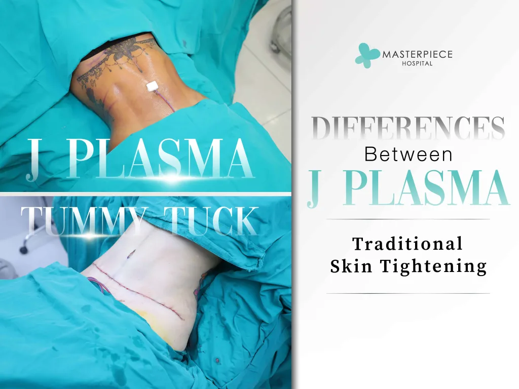 Differences between J-Plasma Skin Tightening and Traditional Skin Tightening