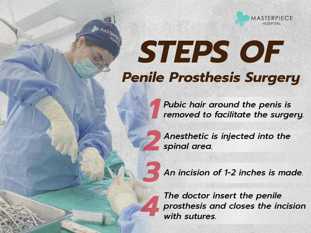 Steps of Penile Prosthesis Surgery