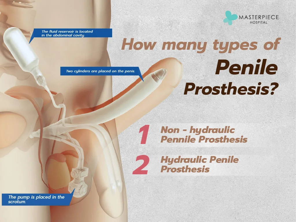 How many types of Penile Prosthesis?
