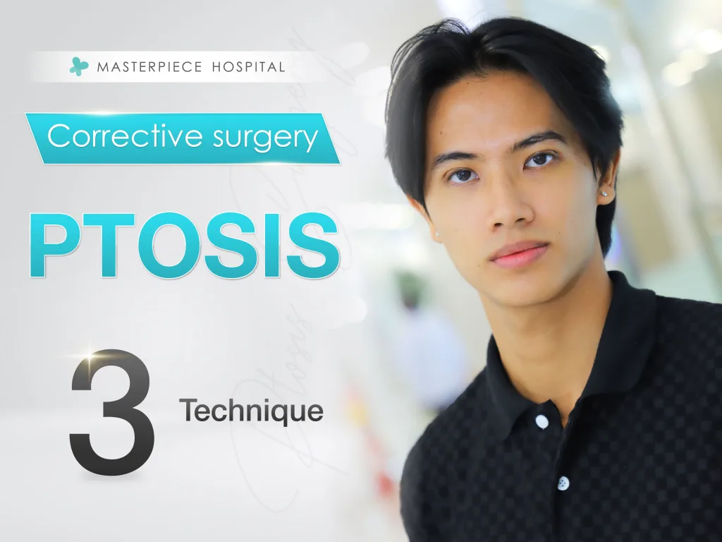 Ptosis Correction Surgery