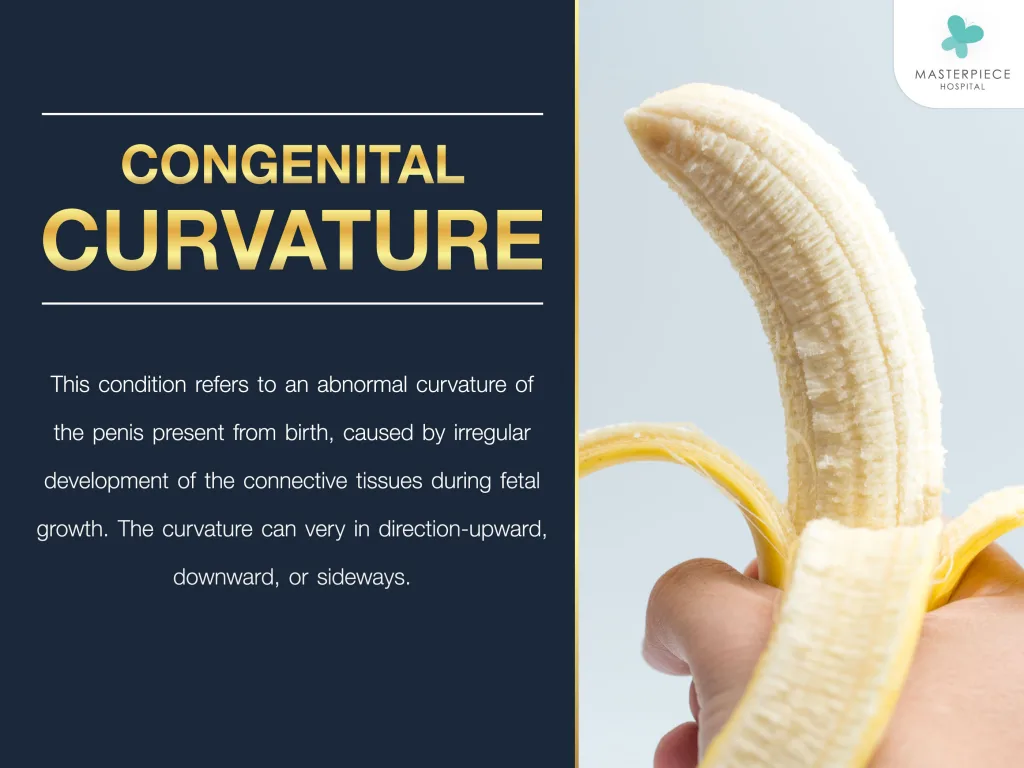 Congenital Penile Curvature