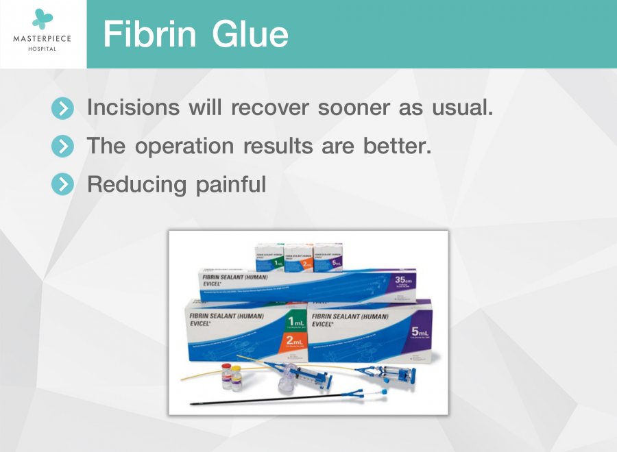 Fibrin Glue