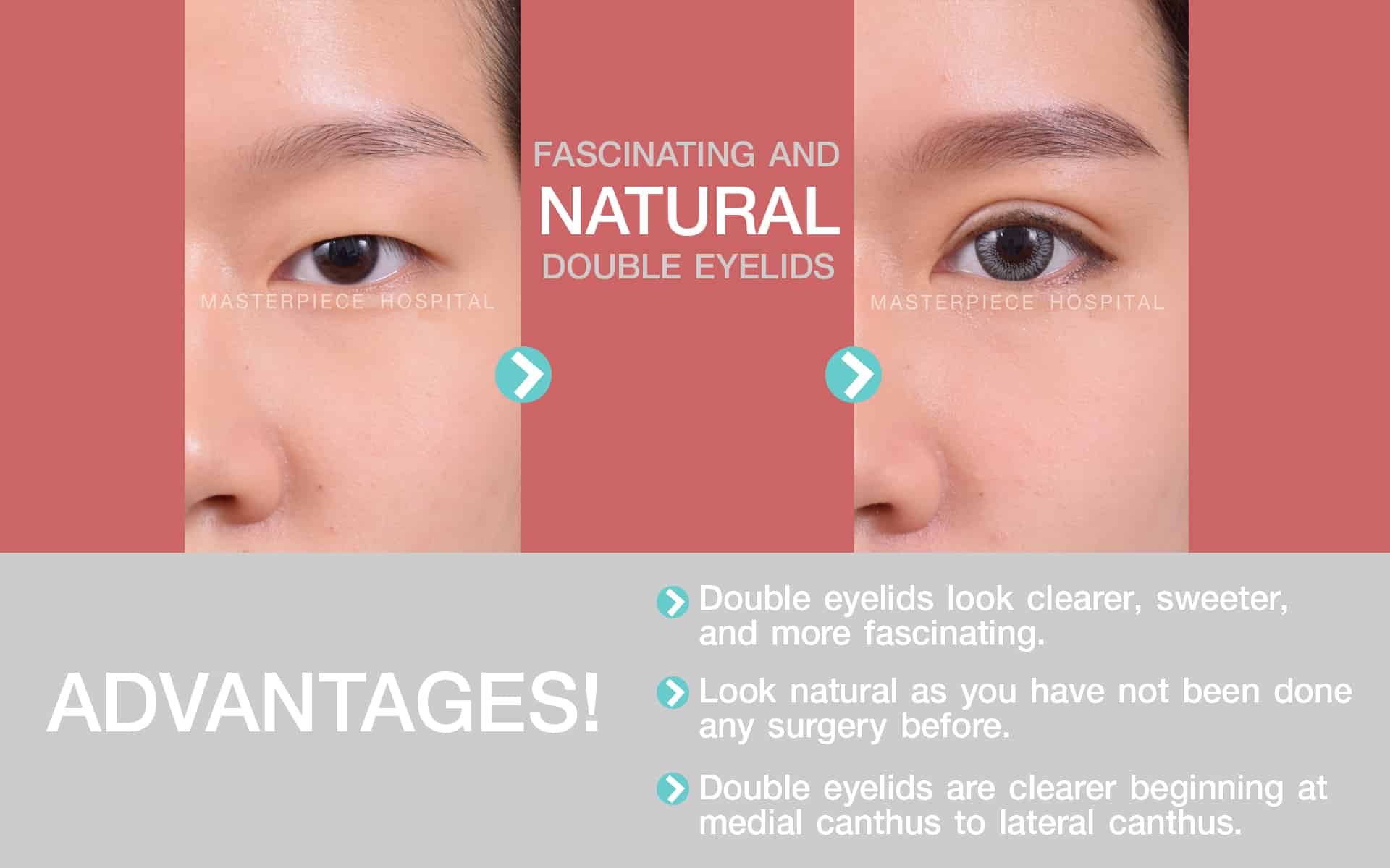 Advantages of this procedure Eye