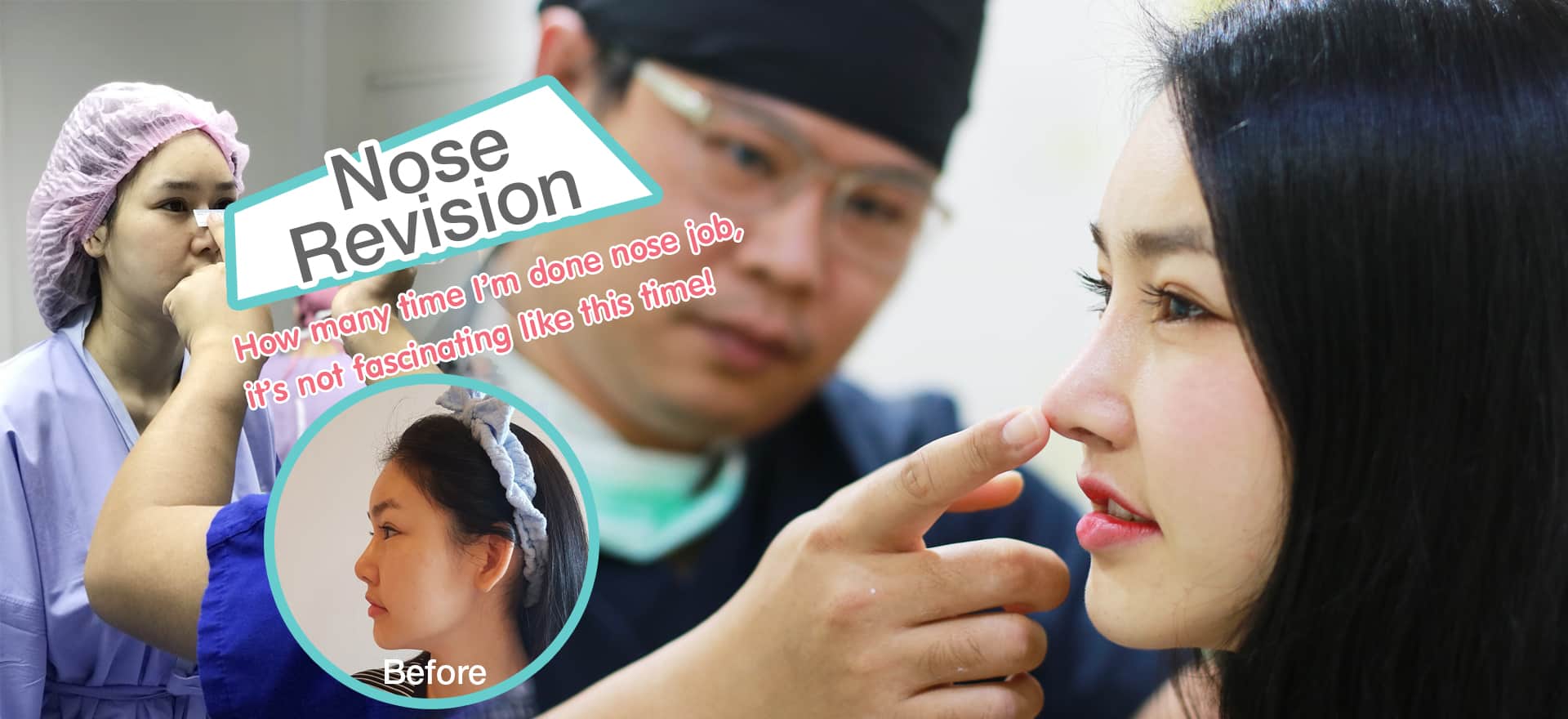 Nose Revision