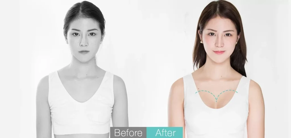 顾客的评价 before-after