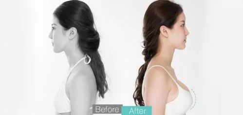 顾客的评价 before-after