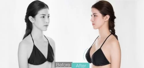 顾客的评价 before-after