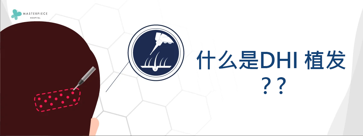 DHI技术种植头发是什么？