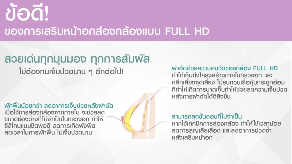 使用全高清(Full HD)的观察摄像技术进行乳房整形手术的特点