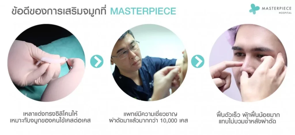 MTP硅胶鼻子的优点