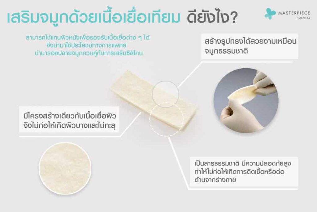 用人造组织来增强鼻子效果有多好?