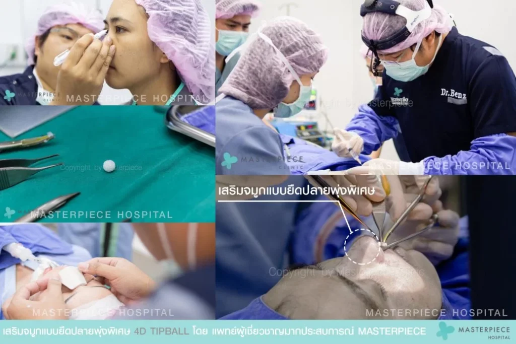 使用特殊的拉伸尖端进行隆鼻