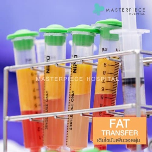 自体脂肪隆胸，使胸部更加饱满