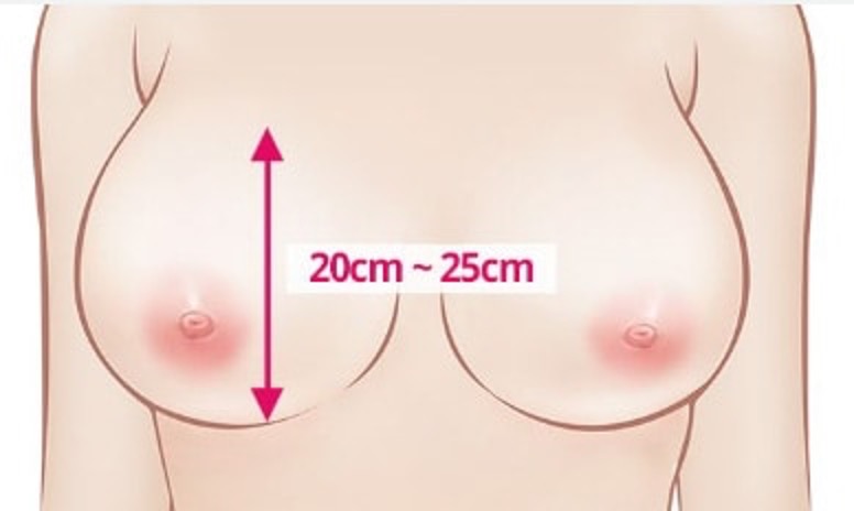 许多胸部较大的女性可能会遇到以下问题