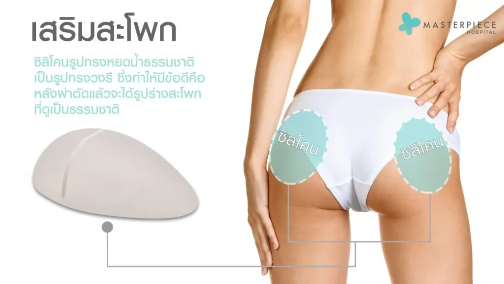 适合进行臀部增大手术的人群包括: