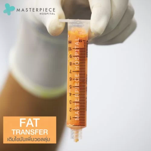 自体脂肪隆胸，使胸部更加饱满