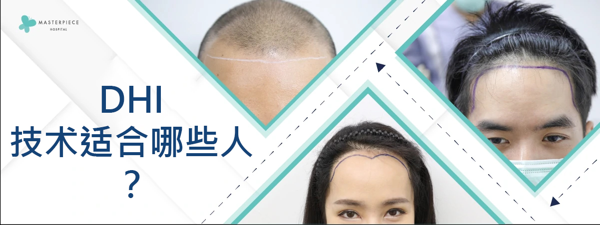 DHI技术适合哪些人？