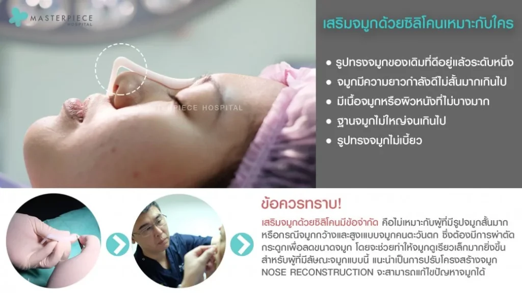 哪些人适合做硅胶隆鼻?