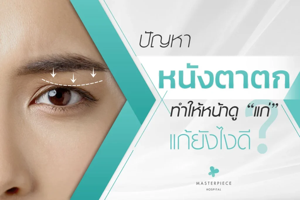 眼皮下垂问题怎么解决才能看起来年轻?