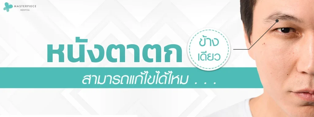 单侧眼睑下垂是否可以矫正呢?