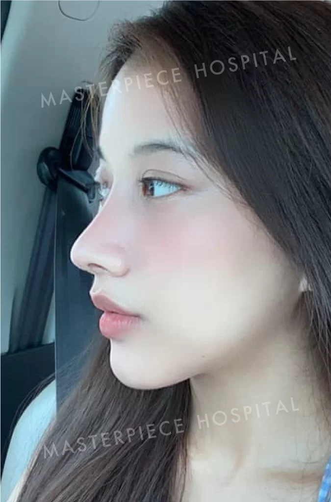 哪个明星人鼻型是泰国女性最想像的！