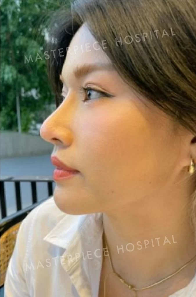 哪个明星人鼻型是泰国女性最想像的！