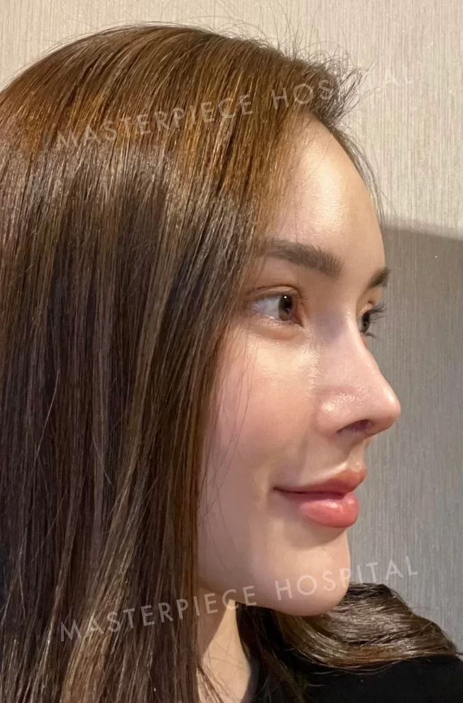 哪个明星人鼻型是泰国女性最想像的！