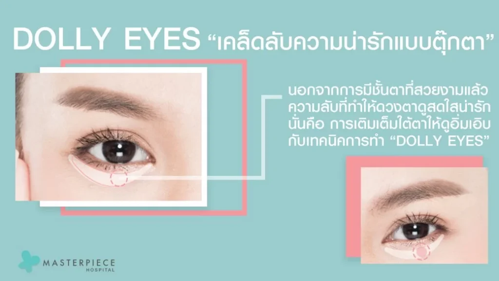 多莉眼 多莉眼让你的眼睛看起来更饱满。明亮的眼睛