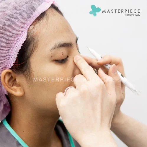 鼻部手术的优点