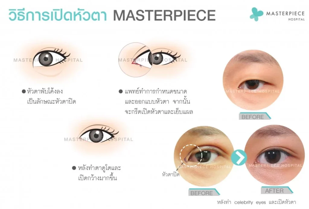 内眼角怎么打开改变您的眼睛形状，使其变得美丽如您所愿。