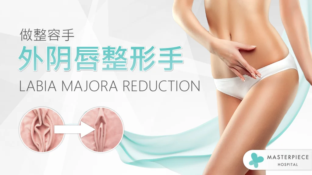 LABIA MAJORA REDUCTION 外阴唇整形手术