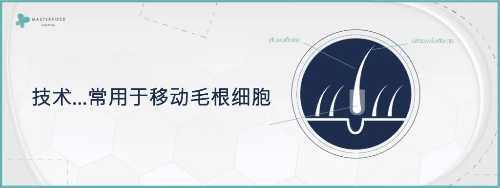 毛囊移植常用技术
