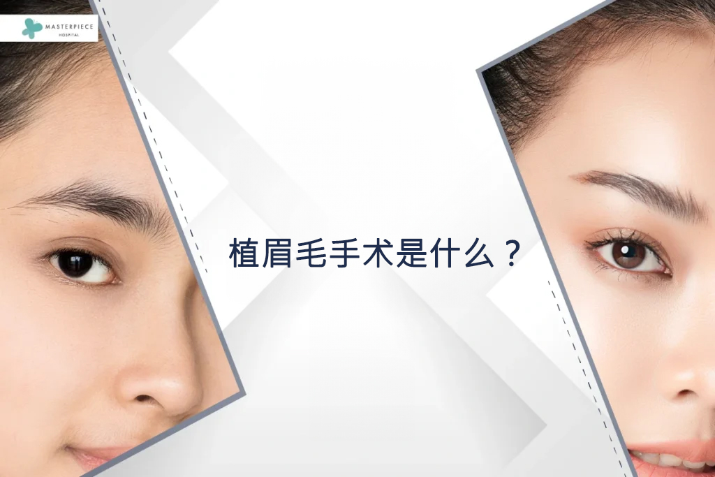 植眉毛手术是什么?