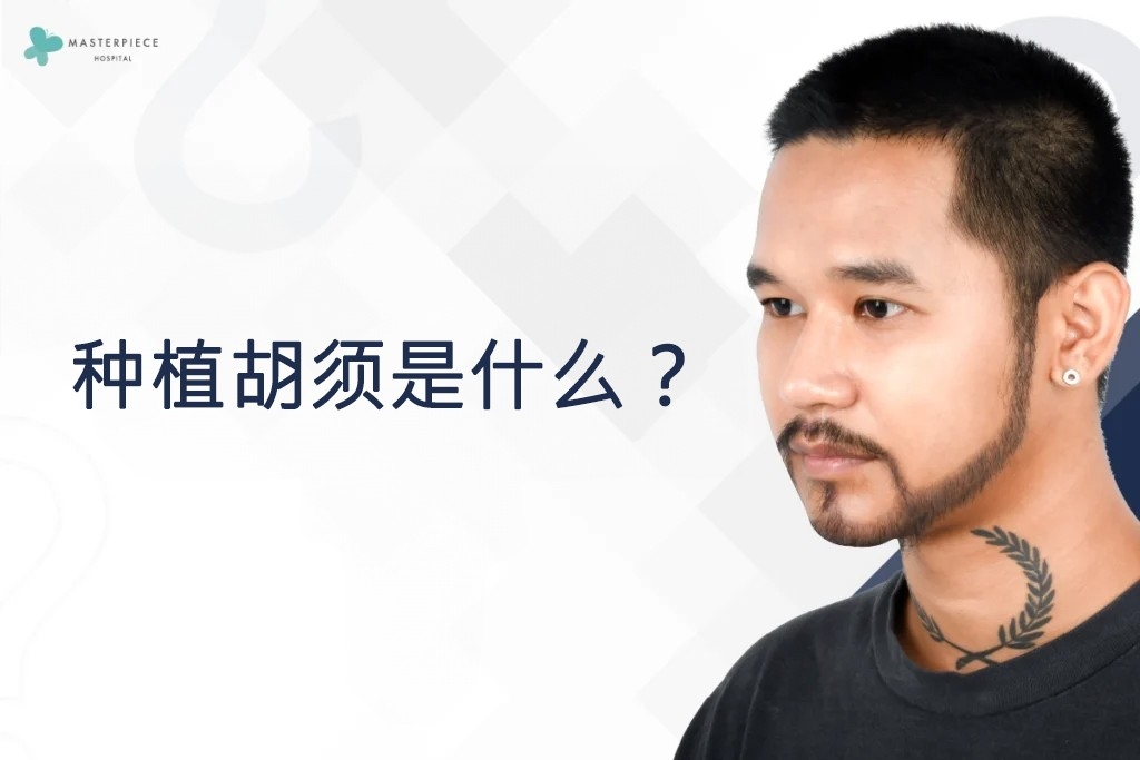 种植胡须是什么？