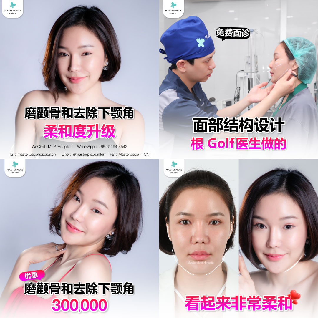 面部整形手术的案例