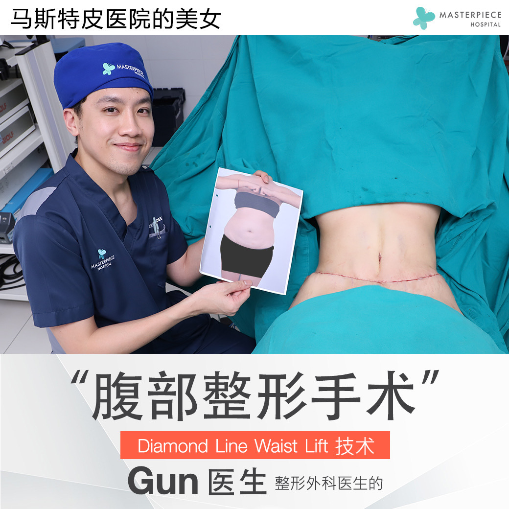 腹部整形手术的案例