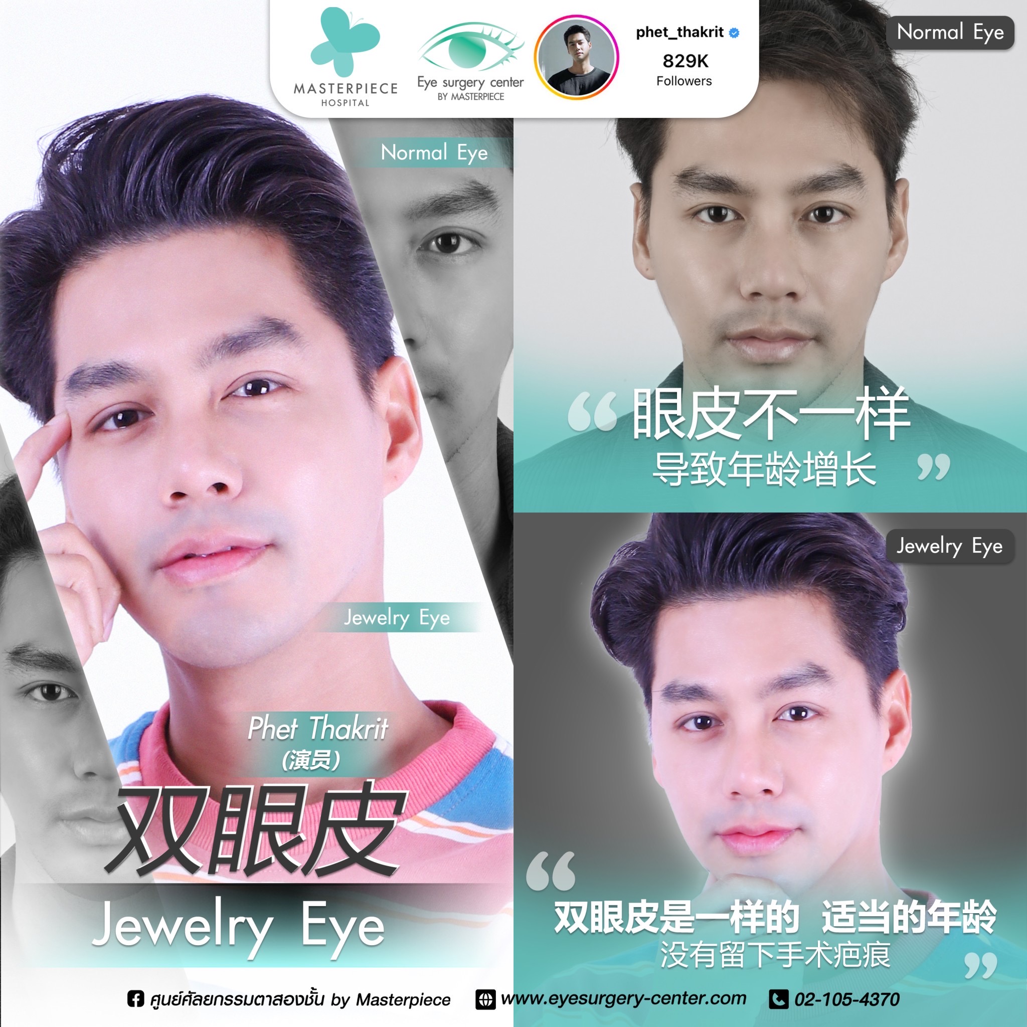 眼睛手术的案例