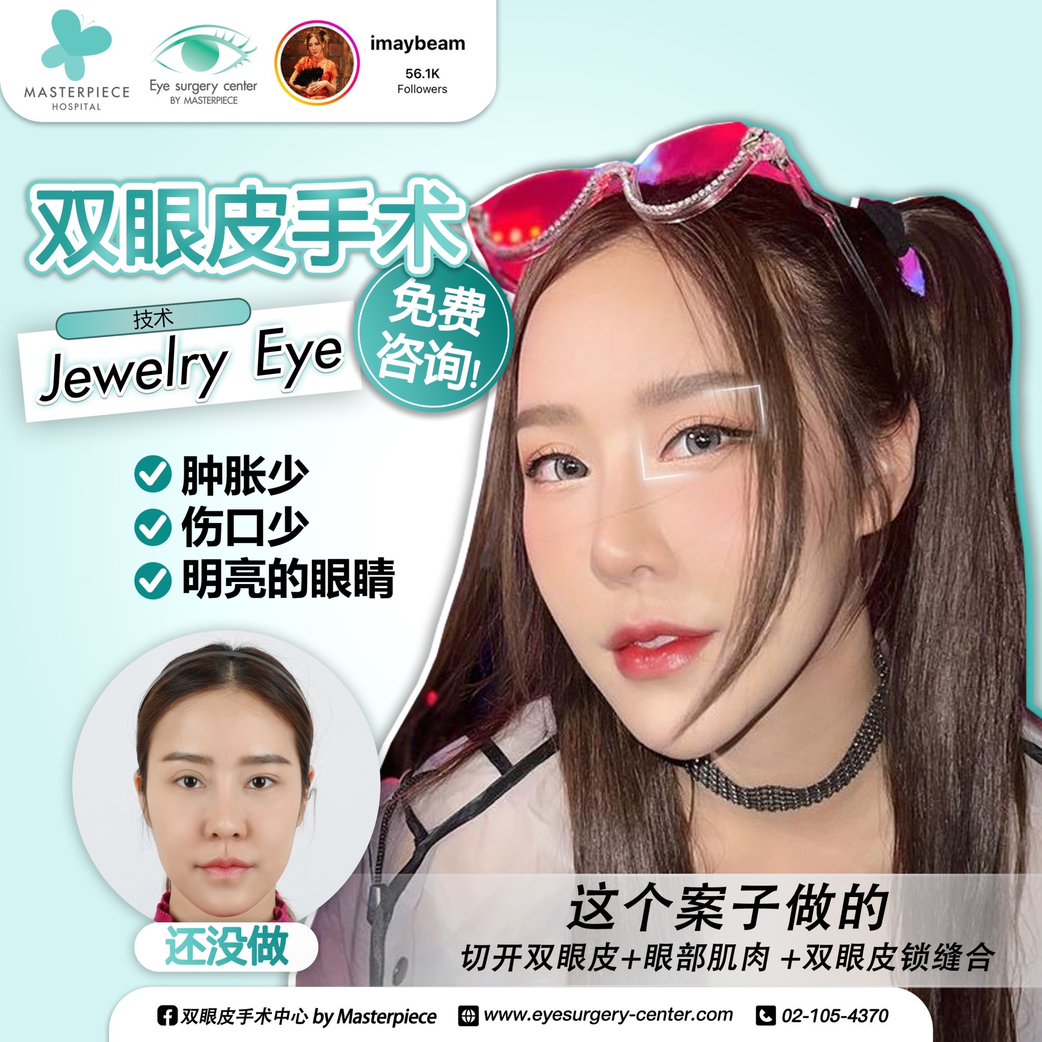 眼睛手术的案例