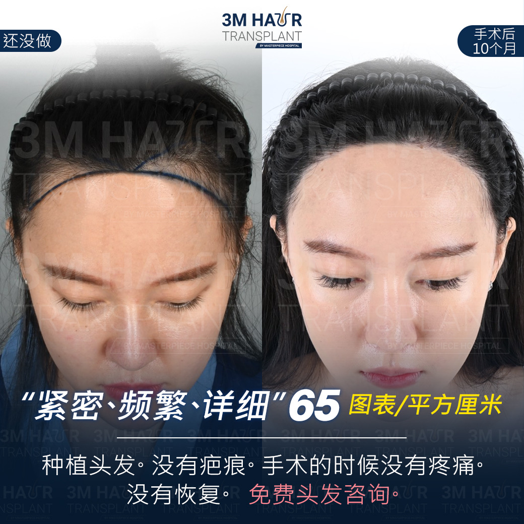 头发护理中心的案例