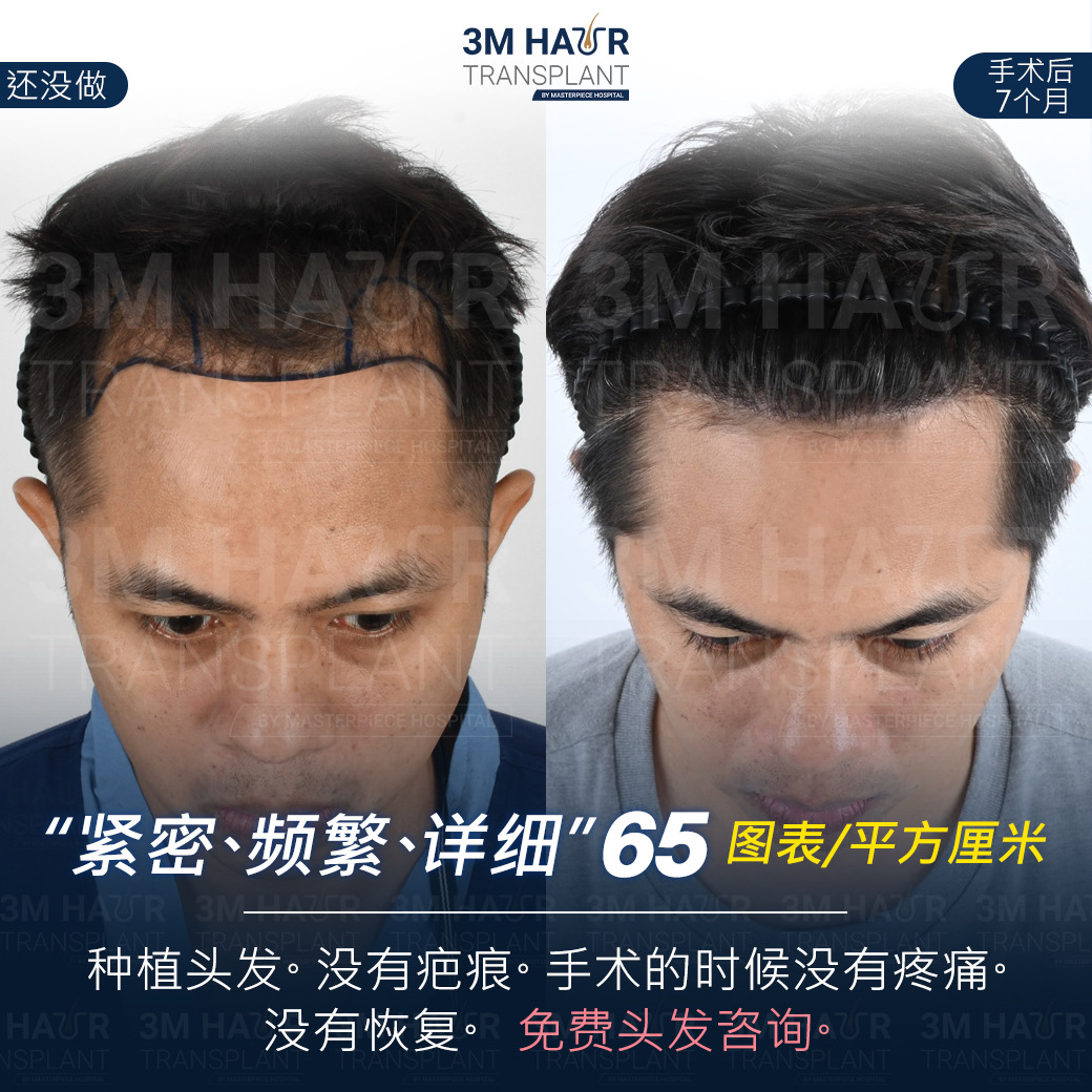 头发护理中心的案例