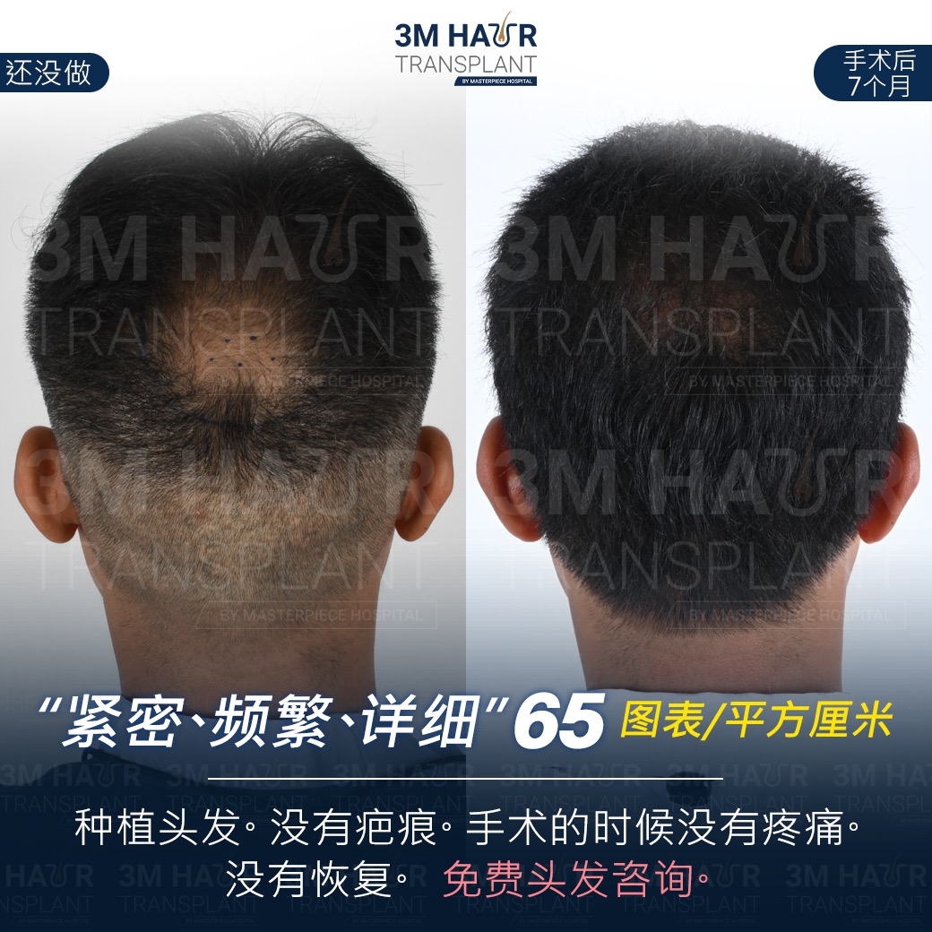 头发护理中心的案例