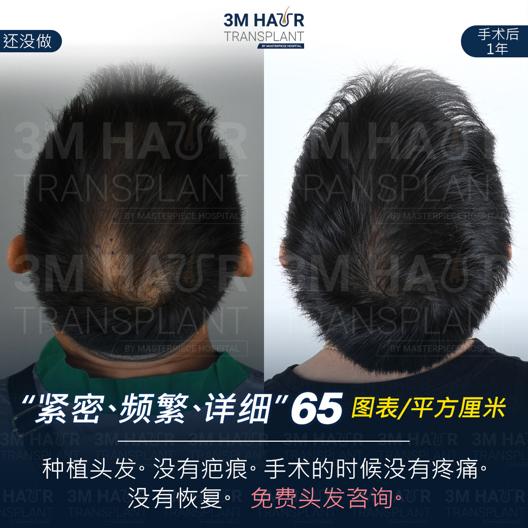 头发护理中心的案例