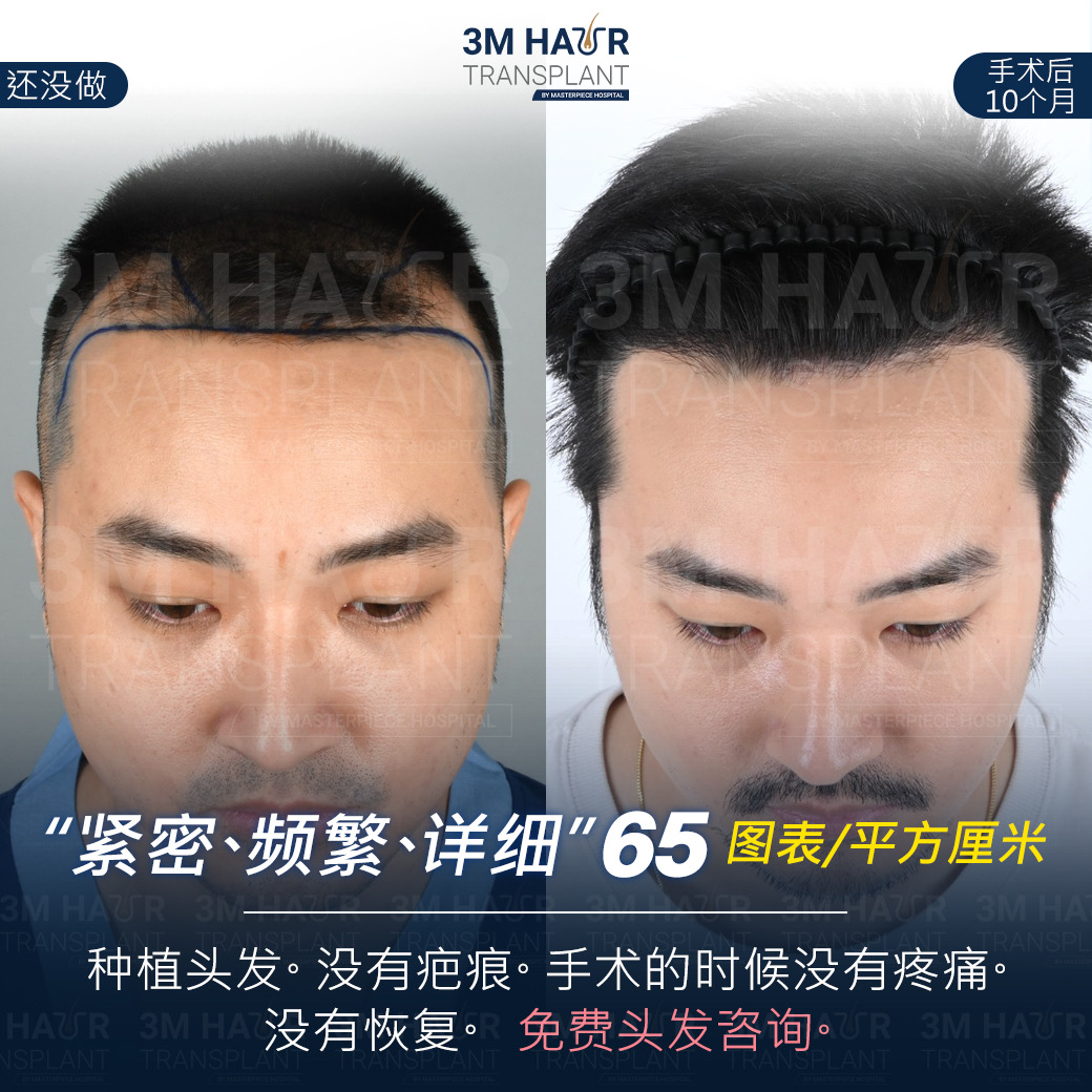 头发护理中心的案例