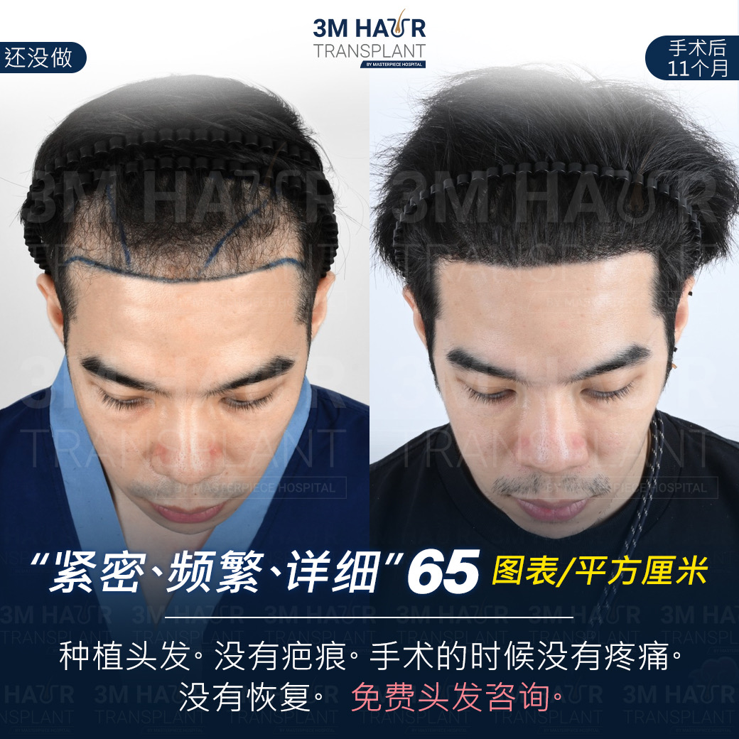 头发护理中心的案例