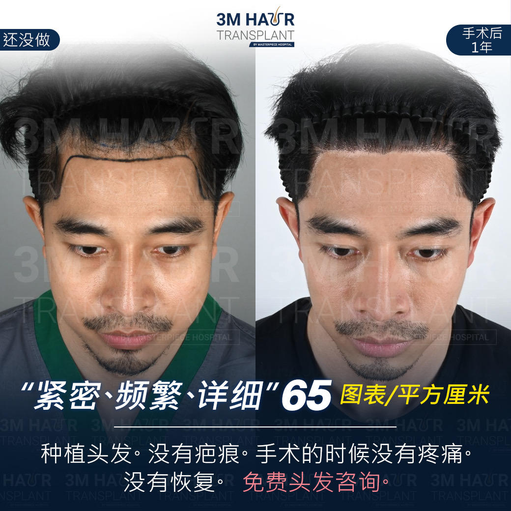 头发护理中心的案例