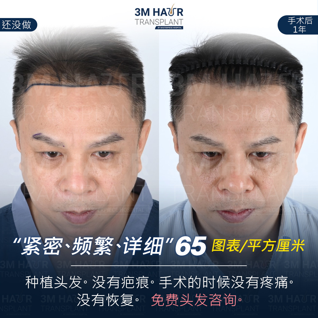 头发护理中心的案例