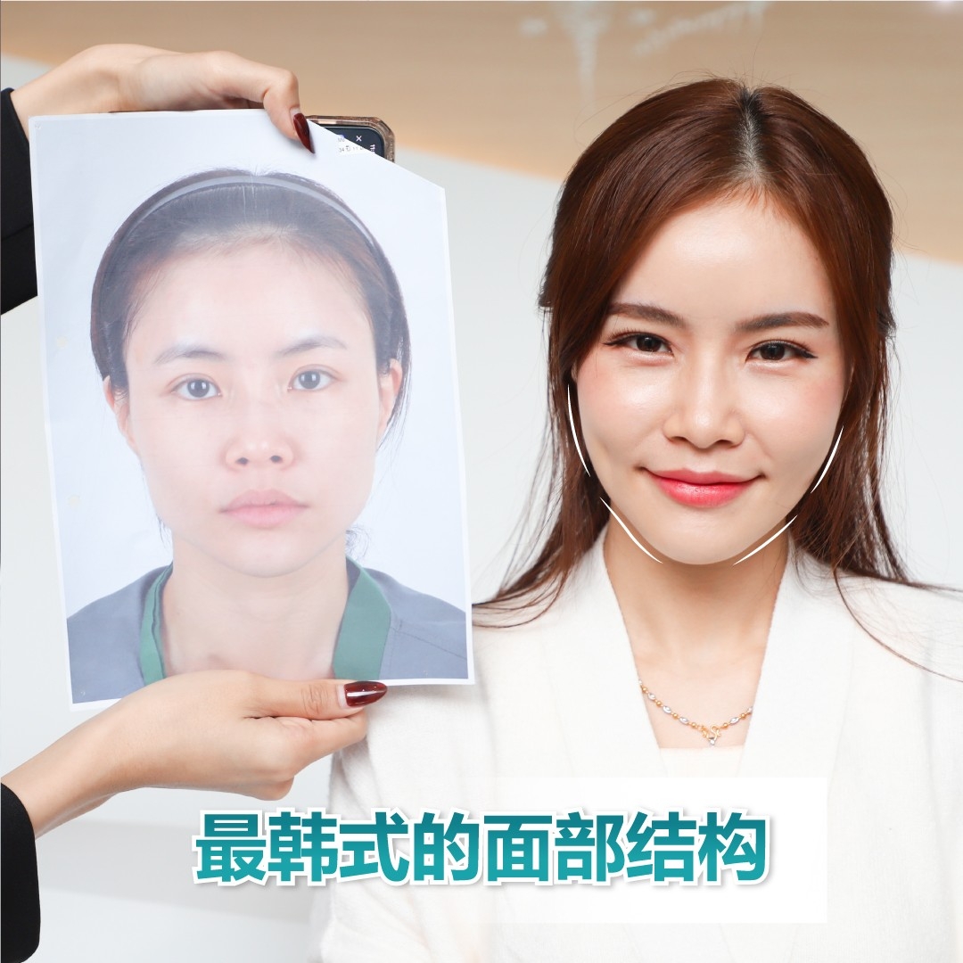 面部整形手术的案例